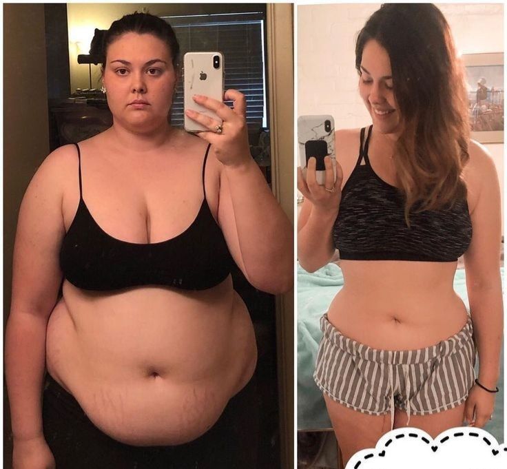 Antes e depois 2