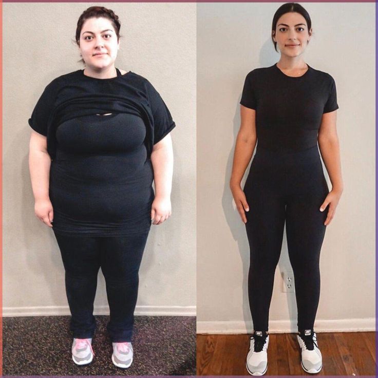 Antes e depois 3